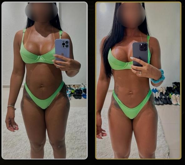 Resultado antes e depois de aluna DFTEAM, foto 3