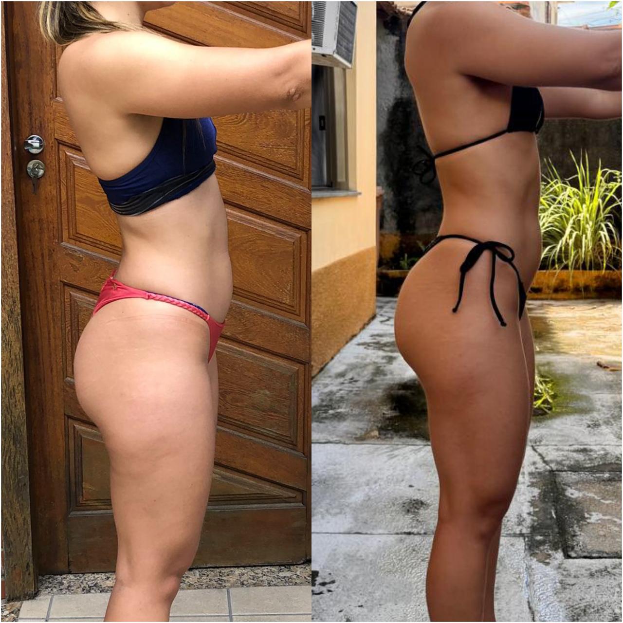 Resultado antes e depois de aluna DFTEAM, foto 6