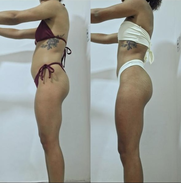 Resultado antes e depois de aluna DFTEAM, foto 21