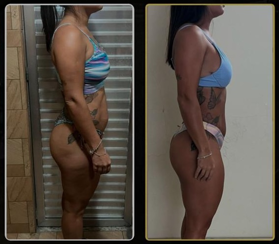 Resultado antes e depois de aluna DFTEAM, foto 15