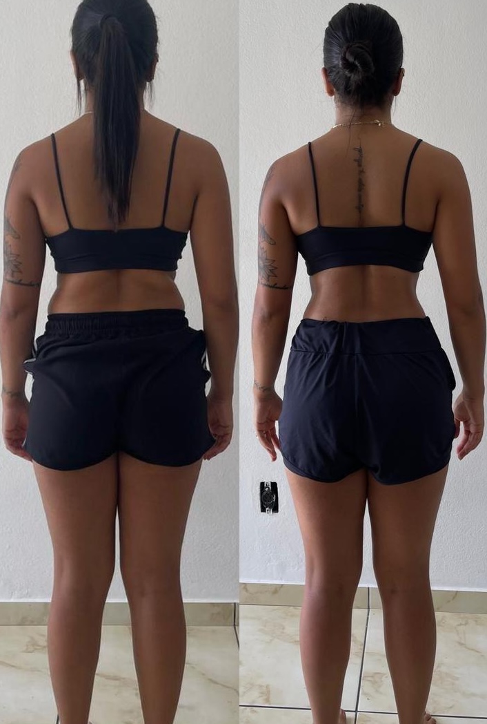 Resultado antes e depois de aluna DFTEAM, foto 9
