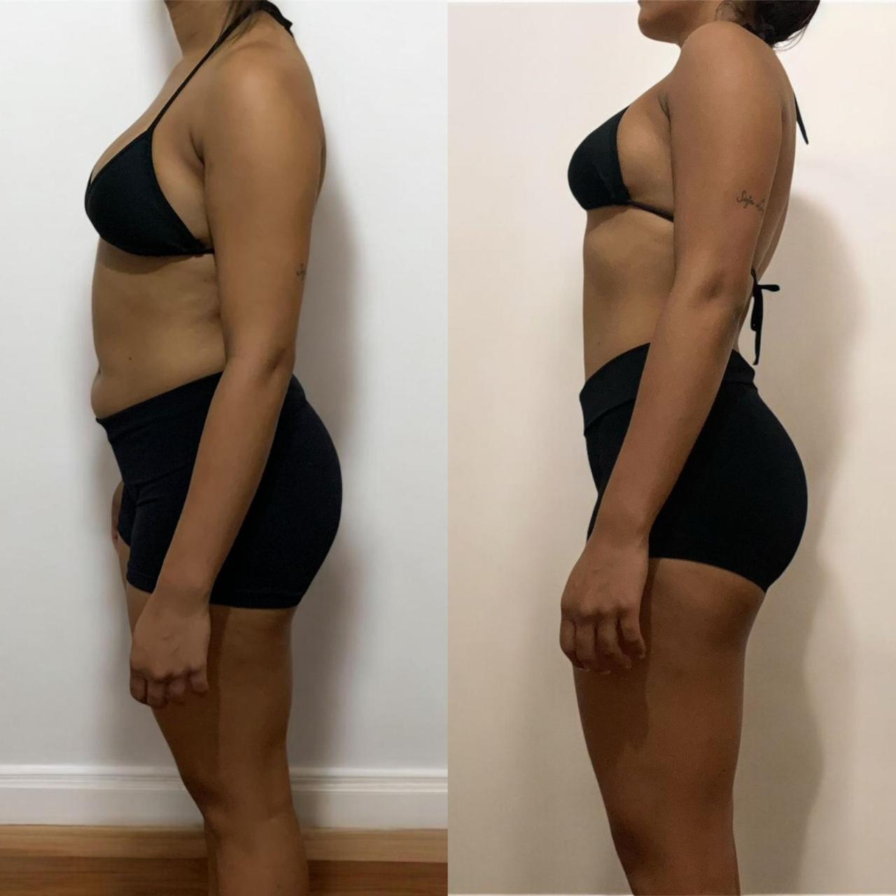 Resultado antes e depois de aluna DFTEAM, foto 17