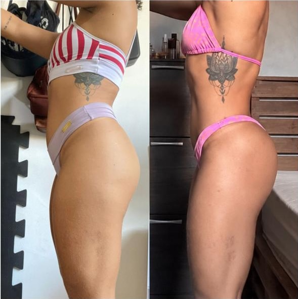 Resultado antes e depois de aluna DFTEAM, foto 31